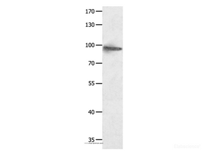Western Blot analysis of Hela cell using HCN1 Polyclonal Antibody at dilution of 1:950