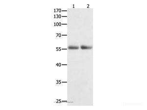 Western Blot analysis of Human colon and kidney cancer tissue using HDAC1 Polyclonal Antibody at dilution of 1:400