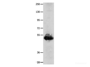 Western Blot analysis of Human lung cancer tissue using BPIFB3 Polyclonal Antibody at dilution of 1:1600