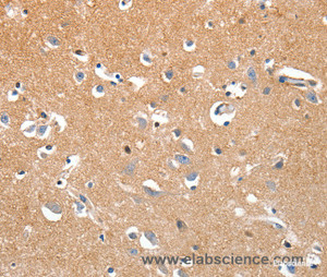 Immunohistochemistry of paraffin-embedded Human brain tissue using LRP3 Polyclonal Antibody at dilution 1:80