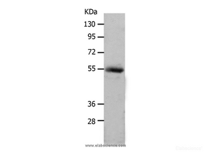 Western Blot analysis of Human colon cancer tissue using MMP17 Polyclonal Antibody at dilution of 1:550