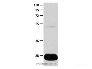 Western Blot analysis of Human liver cancer tissue using POMC Polyclonal Antibody at dilution of 1:450