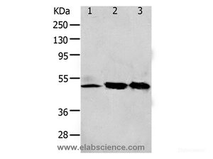Western Blot analysis of 293T and K562 cell, Human fetal kidney tissue using F2R Polyclonal Antibody at dilution of 1:650