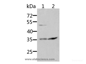 Western Blot analysis of HT-29 and 231 cell using SOCS1 Polyclonal Antibody at dilution of 1:1700