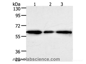 Western Blot analysis of Human liver cancer tissue, hela and 293T cell using AKR1A1 Polyclonal Antibody at dilution of 1:500