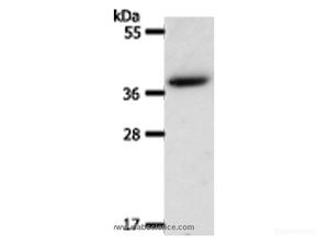 Western Blot analysis of Hela cell using AKR1B1 Polyclonal Antibody at dilution of 1:550