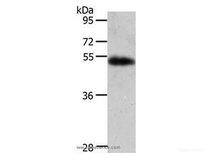 Western Blot analysis of Human liver cancer tissue using AGT Polyclonal Antibody at dilution of 1:700
