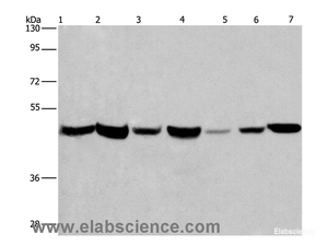 Western Blot analysis of Human placenta and fetal liver tissue, PC3, 231, Hela, HepG2 and A549 cell using APMAP Polyclonal Antibody at dilution of 1:300