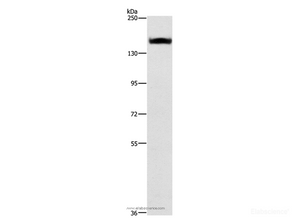 Western Blot analysis of A431 cell using ITGA2 Polyclonal Antibody at dilution of 1:300