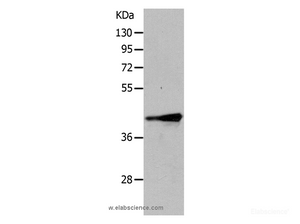 Western Blot analysis of Human fetal muscle tissue using TRIM63 Polyclonal Antibody at dilution of 1:1050