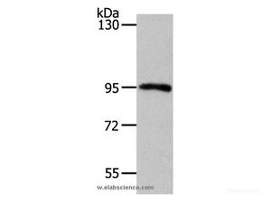 Western Blot analysis of Mouse kidney tissue using MYSM1 Polyclonal Antibody at dilution of 1:1100