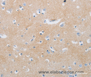 Immunohistochemistry of paraffin-embedded Human brain tissue using CD10 Polyclonal Antibody at dilution 1:85