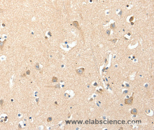 Immunohistochemistry of paraffin-embedded Human brain tissue using RRAD Polyclonal Antibody at dilution 1:50