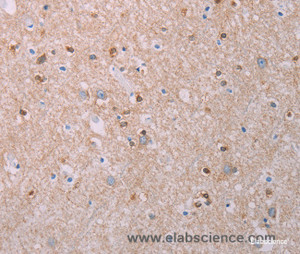 Immunohistochemistry of paraffin-embedded Human brain tissue using AKT2 Polyclonal Antibody at dilution 1:70