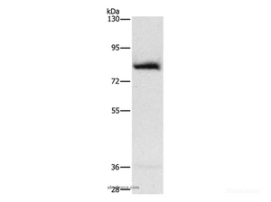 Western Blot analysis of Human fetal muscle tissue using AMPD1 Polyclonal Antibody at dilution of 1:1600