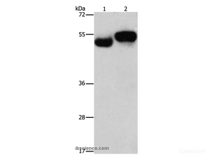 Western Blot analysis of Human fetal brain and liver tissue using AMZ1 Polyclonal Antibody at dilution of 1:1000