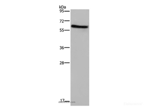 Western Blot analysis of Human placenta tissue using CD297 Polyclonal Antibody at dilution of 1:1000