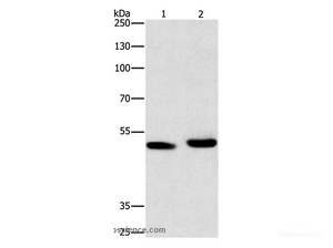 Western Blot analysis of 231 cell and Human liver cancer tissue using ATG4A Polyclonal Antibody at dilution of 1:300