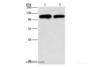 Western Blot analysis of A431 and hela cell using PIP5K1C Polyclonal Antibody at dilution of 1:500