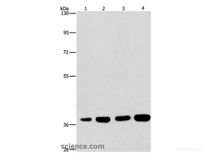 Western Blot analysis of 293T and 231 cell, U937 and Raji cell using SERPINA9 Polyclonal Antibody at dilution of 1:337.5