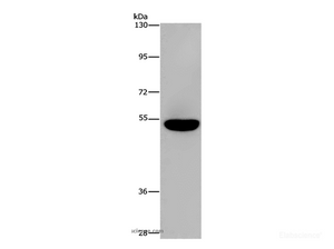 Western Blot analysis of Mouse brain tissue using AHRR Polyclonal Antibody at dilution of 1:860