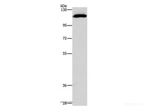 Western Blot analysis of PC3 cell using STAT2 Polyclonal Antibody at dilution of 1:800