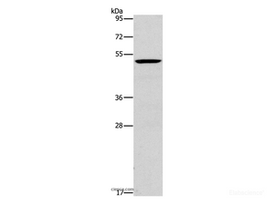 Western Blot analysis of Mouse liver tissue using PLIN2 Polyclonal Antibody at dilution of 1:600