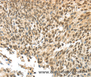 Immunohistochemistry of paraffin-embedded Human tonsil tissue using APOL6 Polyclonal Antibody at dilution 1:60