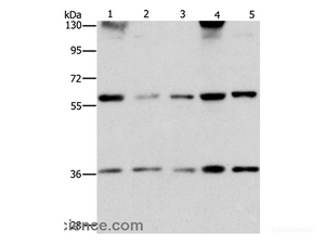 Western Blot analysis of PC3 and hela cell, Human bladder carcinoma tissue and A172 cell, hepG2 cell using STK4 Polyclonal Antibody at dilution of 1:1000