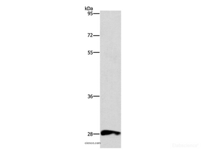 Western Blot analysis of Raw264.7 cell using CD48 Polyclonal Antibody at dilution of 1:500