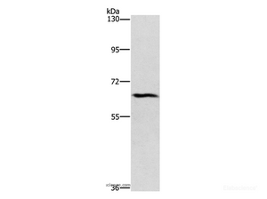 Western Blot analysis of Hela cell using CERKL Polyclonal Antibody at dilution of 1:1100