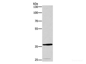 Western Blot analysis of Hela cell using DUSP2 Polyclonal Antibody at dilution of 1:300