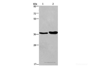 Western Blot analysis of Human testis tissue and transitional cell carcinoma of bladder tissue using FUT1 Polyclonal Antibody at dilution of 1:250