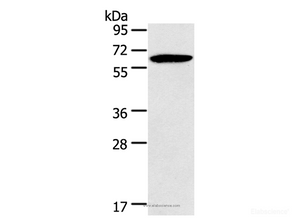 Western Blot analysis of Mouse brain tissue using HMGCS2 Polyclonal Antibody at dilution of 1:200