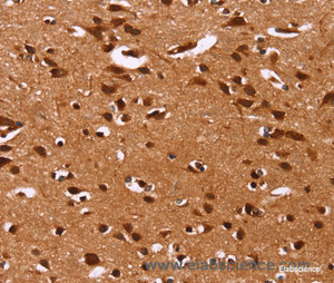 Immunohistochemistry of paraffin-embedded Human brain tissue using HRK Polyclonal Antibody at dilution 1:40