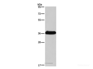 Western Blot analysis of Mouse skeletal muscle tissue using IFNGR2 Polyclonal Antibody at dilution of 1:400