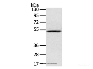 Western Blot analysis of Human normal liver tissue using IL17RB Polyclonal Antibody at dilution of 1:200