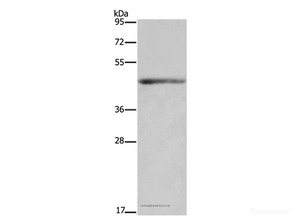 Western Blot analysis of Mouse heart tissue using IL5RA Polyclonal Antibody at dilution of 1:650