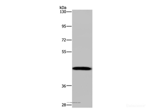 Western Blot analysis of Human hepatocellular carcinoma tissue using CYP1A2 Polyclonal Antibody at dilution of 1:440