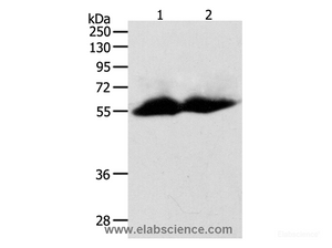 Western Blot analysis of Human colon and ovarian cancer tissue using MMP11 Polyclonal Antibody at dilution of 1:600