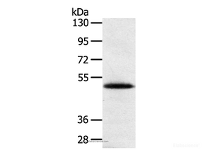 Western Blot analysis of Human placenta tissue using SMOC2 Polyclonal Antibody at dilution of 1:250