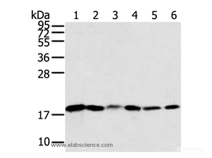 Western Blot analysis of Human colon sigmoideum cancer and colon cancer tissue, Mouse lung and Human normal colon tissue, lovo and hela cell using SNX3 Polyclonal Antibody at dilution of 1:250