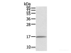 Western Blot analysis of Human normal liver tissue using EVA1A Polyclonal Antibody at dilution of 1:550