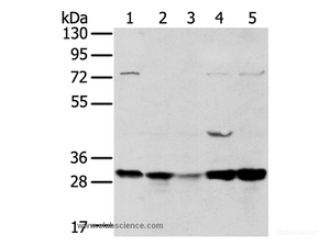 Western Blot analysis of 293T and MCF7 cell, Mouse brain tissue and K562 cell, Mouse bladder tissue using TPD54 Polyclonal Antibody at dilution of 1:400