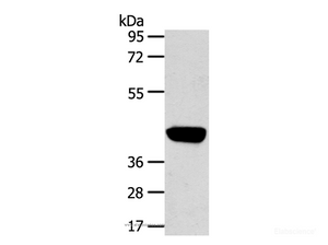 Western Blot analysis of Hepg2 cell using PRSS50 Polyclonal Antibody at dilution of 1:450