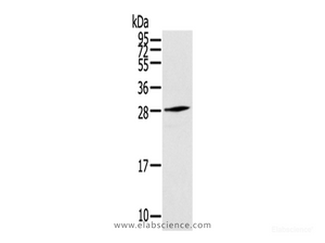 Western Blot analysis of Human fetal muscle tissue using THYN1 Polyclonal Antibody at dilution of 1/800