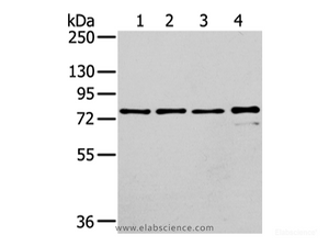 Western Blot analysis of Raji, K562, skov3 and pc3 cell using GHR Polyclonal Antibody at dilution of 1/400