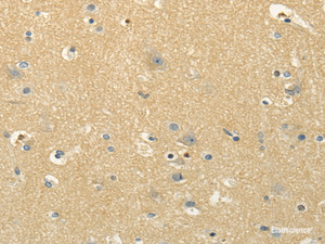 Immunohistochemistry of paraffin-embedded Human brain using MSI1 Polyclonal Antibody at dilution of 1/30