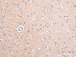 Immunohistochemistry of paraffin-embedded Human brain tissue using GJB5 Polyclonal Antibody at dilution 1:45