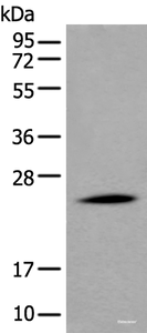 Western blot analysis of Human liver tissue lysate using APOD Polyclonal Antibody at dilution of 1:550